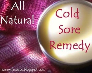 Cold Sore Natural Remedy Recipe