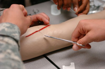 How To Stitch A Wound In An Emergency 