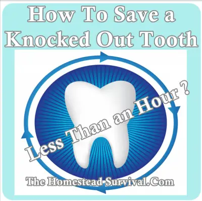 How To Save a Knocked Out Tooth