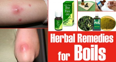 Healing Herbal Remedies for Boils