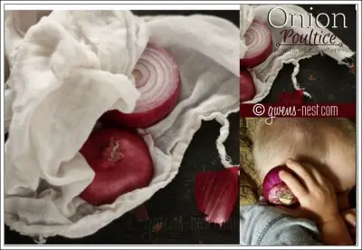 How to Relieve Pain with an Onion Poultice Home Remedy