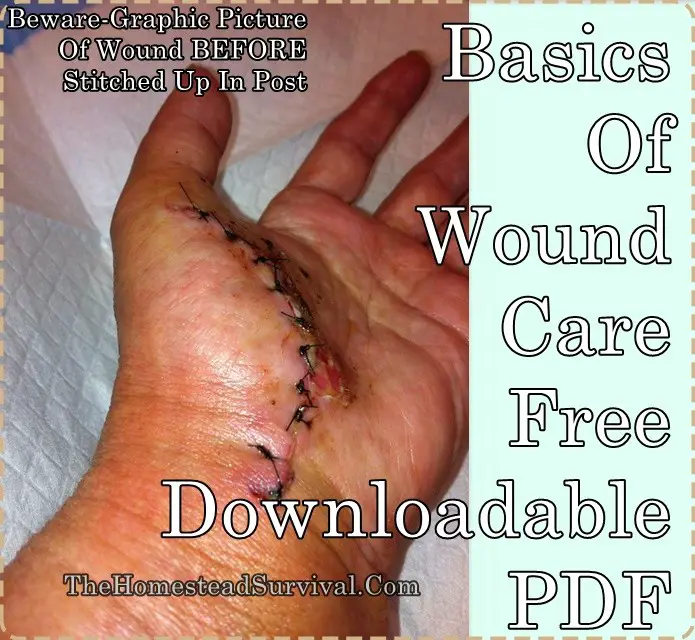 Basics-Of-Wound-Care-Free-Downloadable-PDF