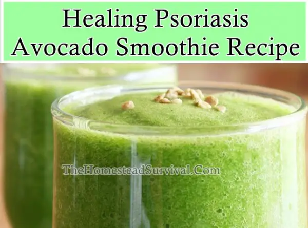 Healing Psoriasis Avocado Smoothie Recipe