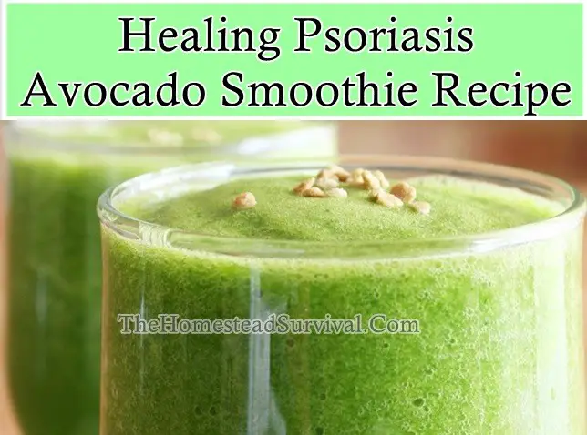 Healing Psoriasis Avocado Smoothie Recipe