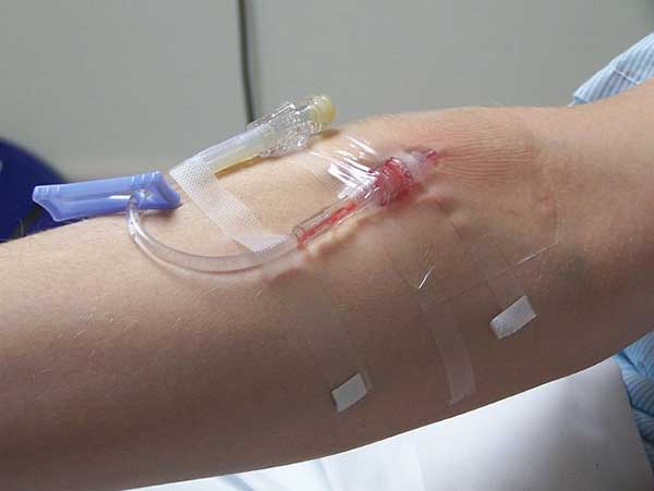 How To Start An IV Intravenous Therapy