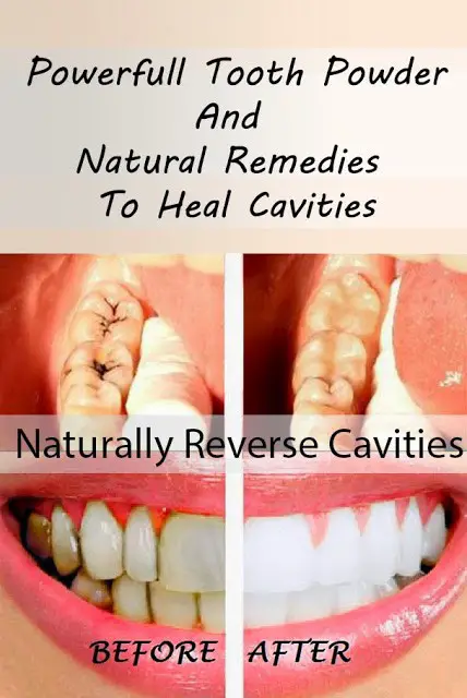 Homemade Tooth Powder That May Heal Cavities