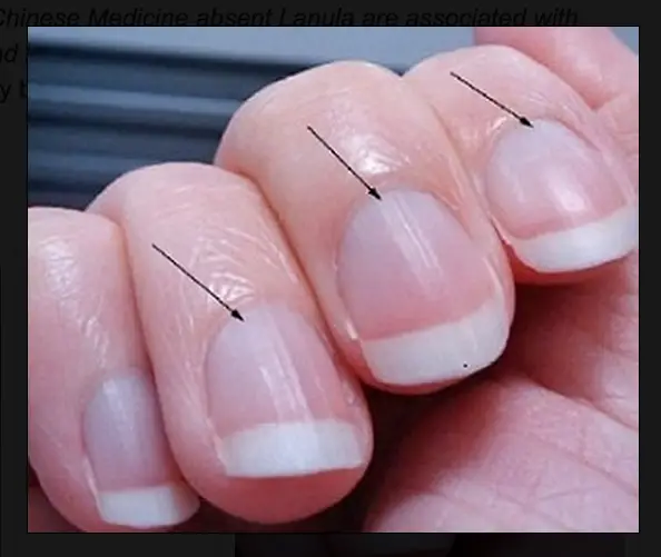 Look At Your FINGERNAILS For Clues If You Have LOW ENERGY