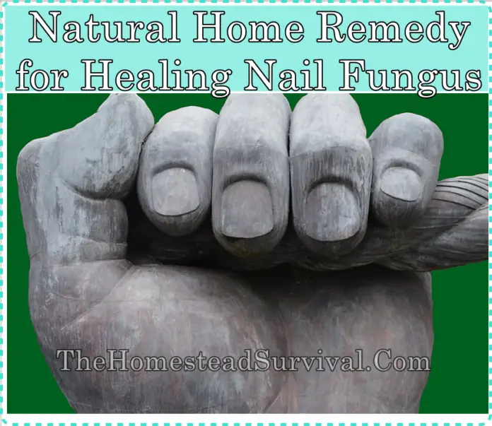 Natural Home Remedy for Healing Nail Fungus