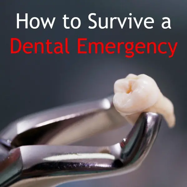 How to Prepare for and Survive a Dental Emergency
