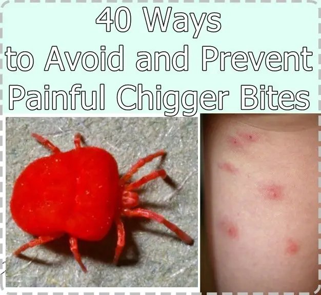 40 Ways to Avoid and Prevent Painful Chigger Bites