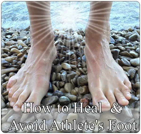 How to Heal and Avoid Athlete's Foot