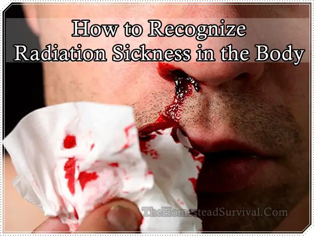 How to Recognize Radiation Sickness in the Body