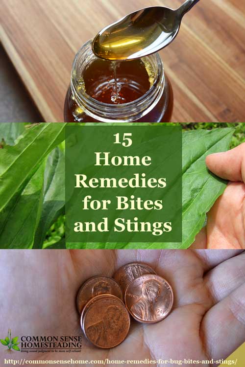 Home Remedies for Bug Bites and Stings