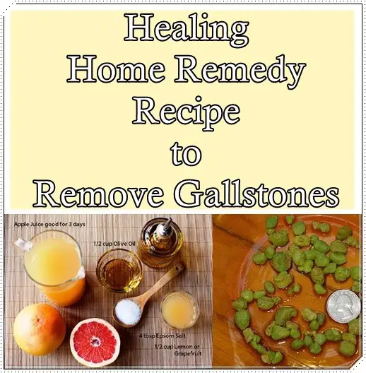 Healing Home Remedy Recipe to Remove Gallstones