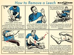 How to Remove a Blood Sucking Leech - The Homestead Survival