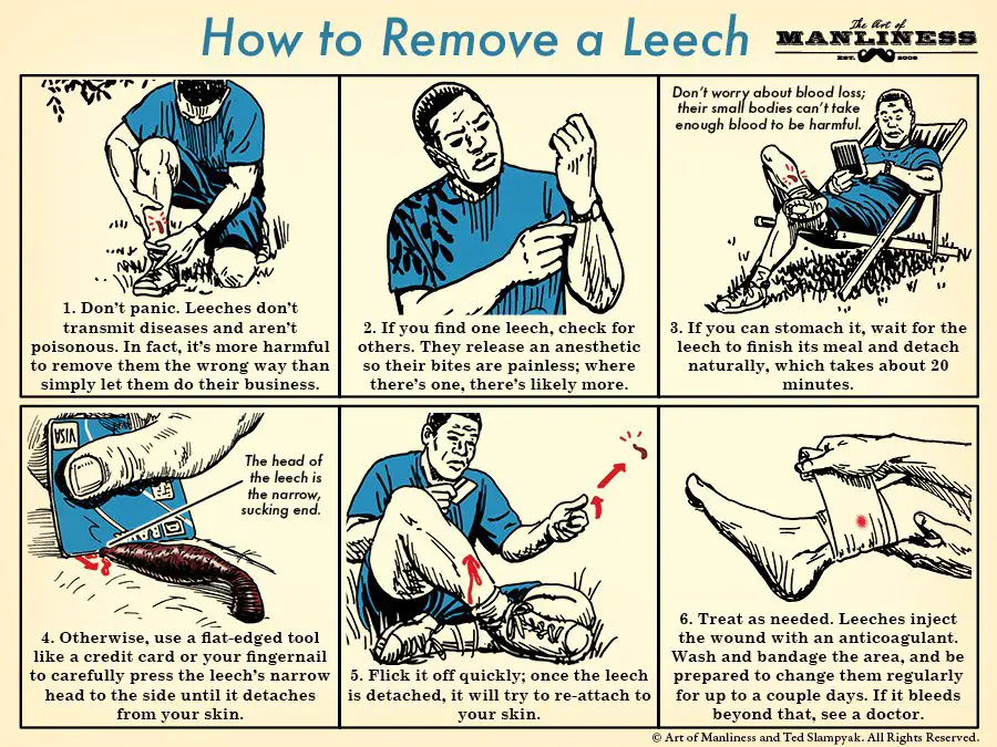 How to Remove a Blood Sucking Leech