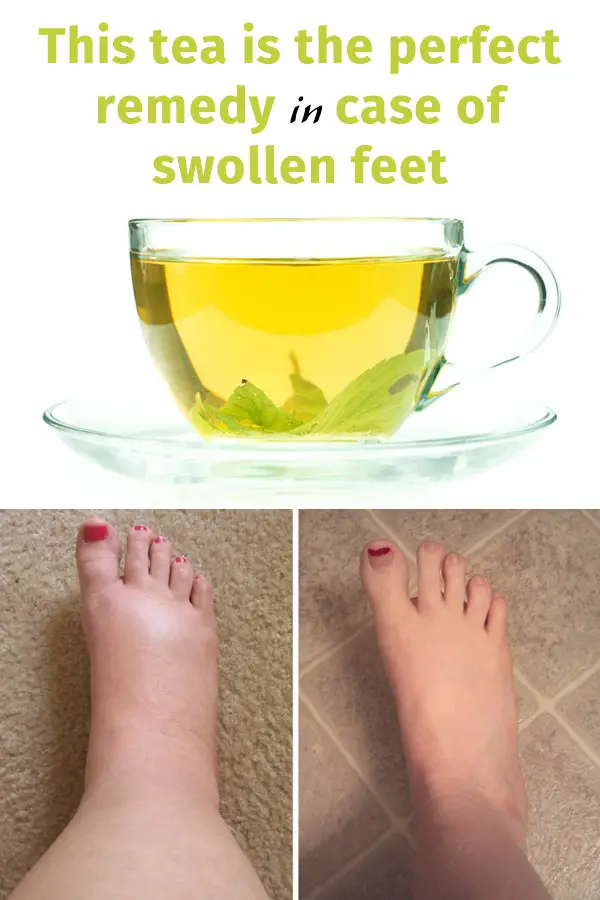 A Homemade Tea For Occasional Swollen Feet