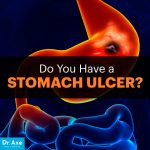 Stomach Ulcer Symptoms and How To Heal - The Homestead Survival