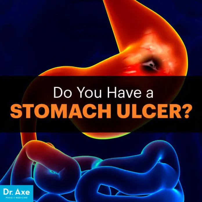 Stomach Ulcer Symptoms and How To Heal