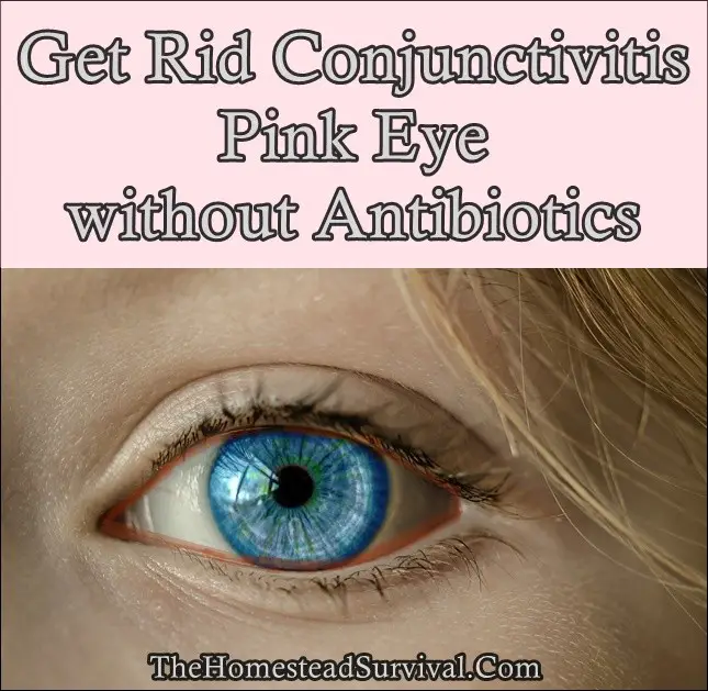 Get Rid Conjunctivitis Pink Eye without Antibiotics