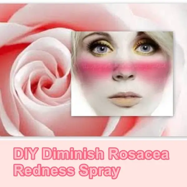 DIY Diminish Rosacea Redness Spray