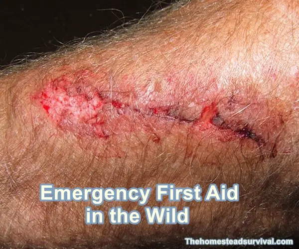 Emergency First Aid in the Wild