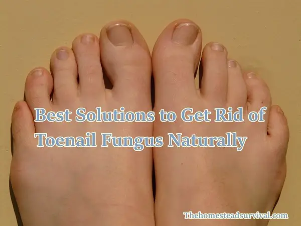 Best Solutions to Get Rid of Toenail Fungus Naturally