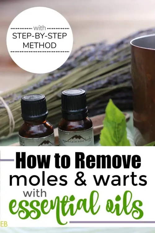 Naturally Remove Moles and Warts