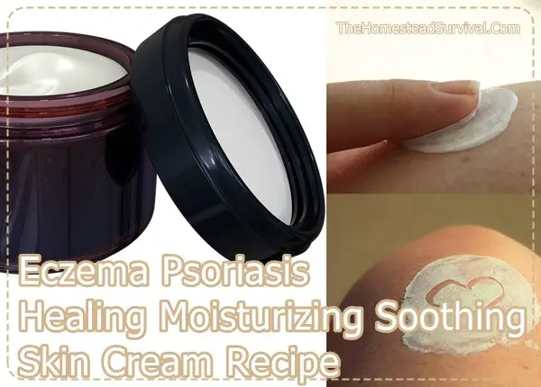 Eczema Psoriasis Healing Moisturizing Soothing Skin Cream Recipe