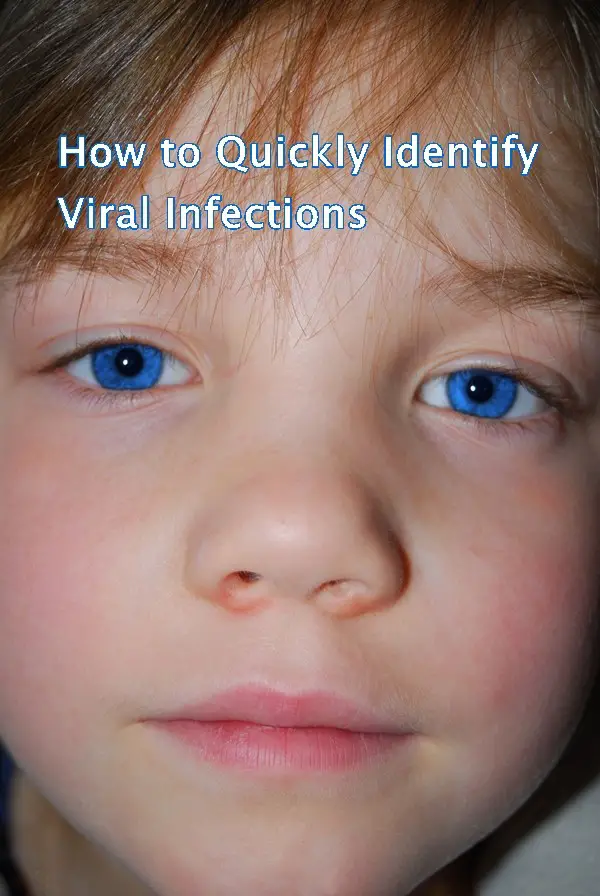 How to Quickly Identify Viral Infections