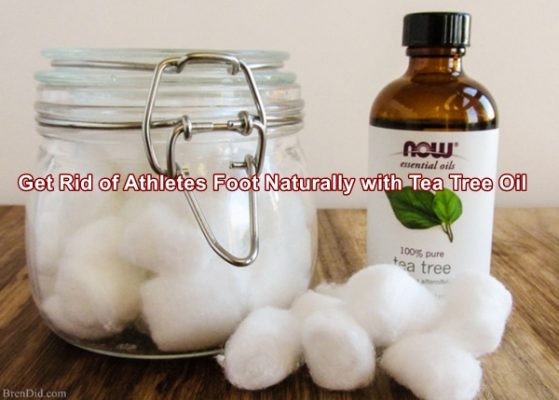 Get Rid of Athletes Foot Naturally with Tea Tree Oil
