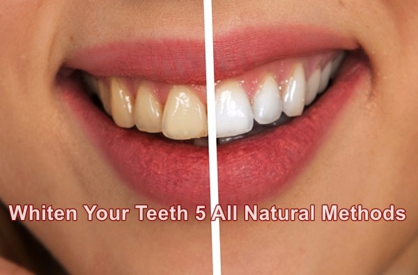 Whiten Your Teeth 5 All Natural Methods