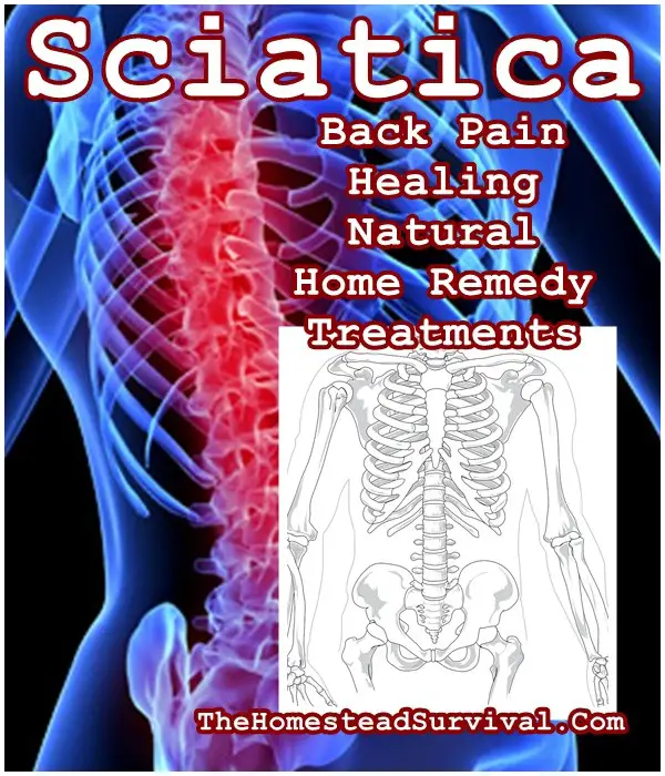 Sciatica Back Pain Healing Natural Home Remedy Treatments - The Homestead Survival