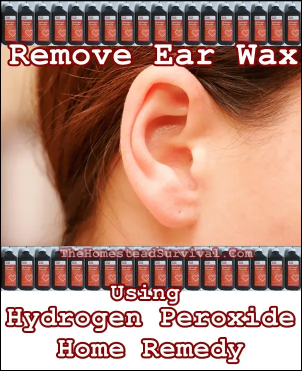 Remove Ear Wax Using Hydrogen Peroxide Home Remedy - The Homestead Survival
