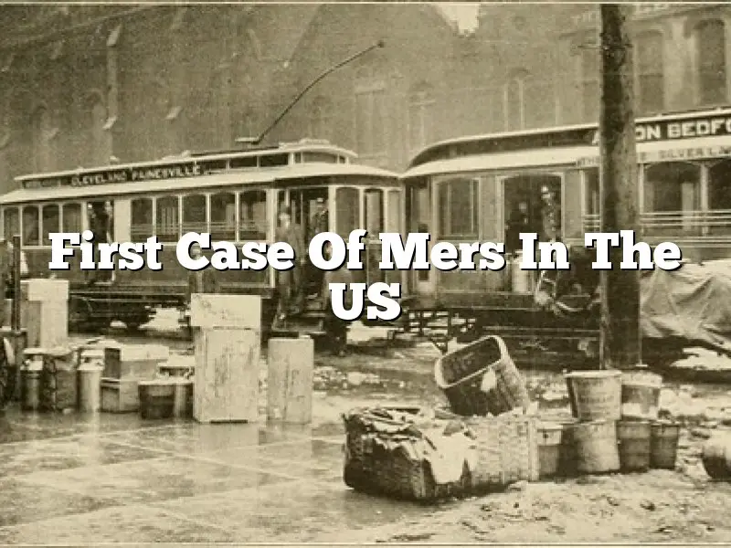First Case Of Mers In The US