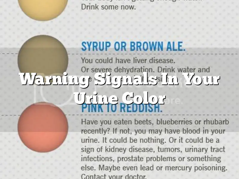 Warning Signals In Your Urine Color