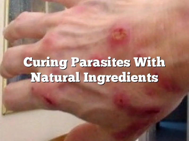 Curing Parasites With Natural Ingredients